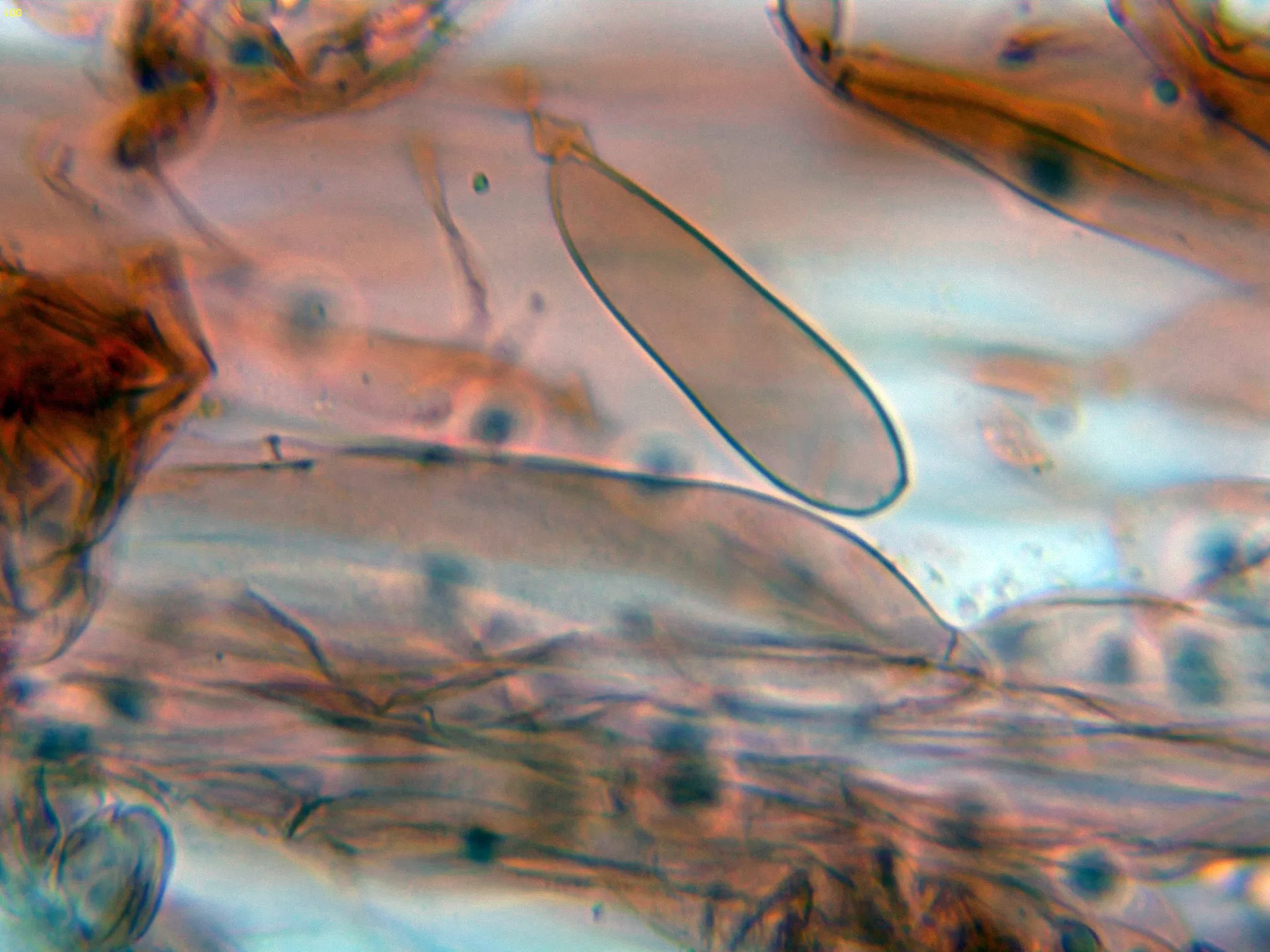 Microscopía de Mycena epipterygia - 10 - Subpellis-001